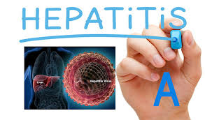 hepatitis a