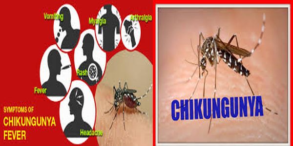 chikguniya