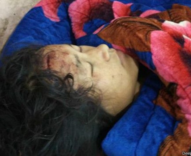 फोटो पत्रकार दीपक का कहना है कि उन्होंने क़रीब 35 घायलों को अस्पताल में देखा है.